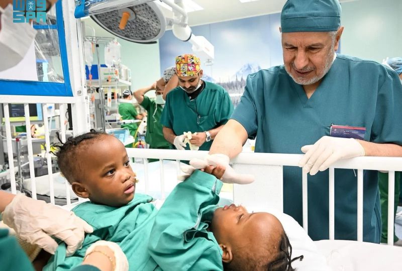 Separation surgery of Tanzanian conjoined twins begins in Riyadh
